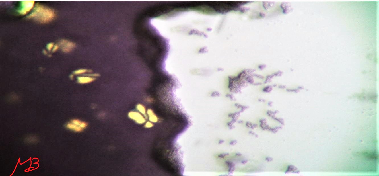 saccaromycaes cerevisiae (? )